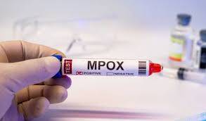 لاہور میں منکی پاکس (Mpox) کے تین نئے کیسز رپورٹ، صحت سے متعلق الرٹ جاری